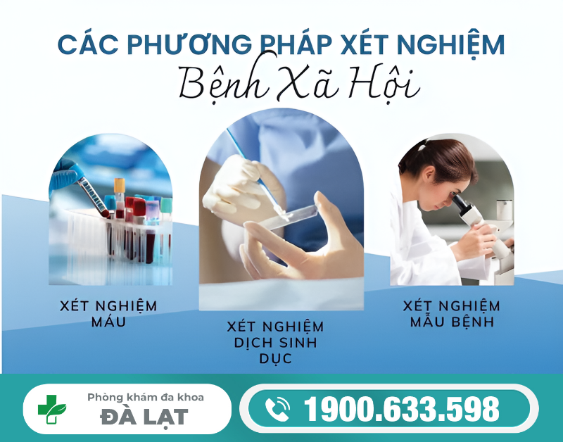 Hình ảnh minh họa